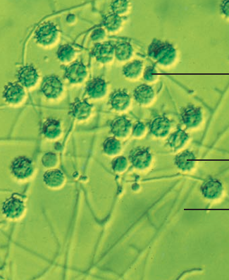 image 110 Light micrograph of the mycelia, microconidia and macroconidia of H. capsulatum.
