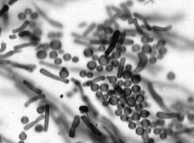 image 20 M. globose mounted in KOH and ink