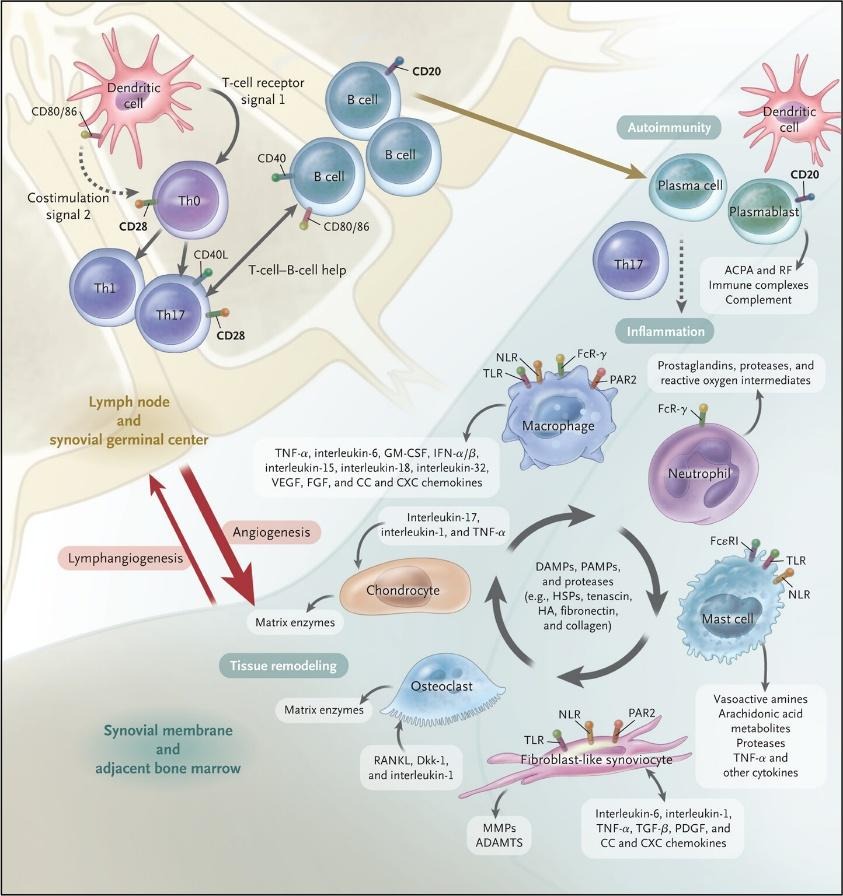 image 22 rheumatoid arthritis pathophysiology