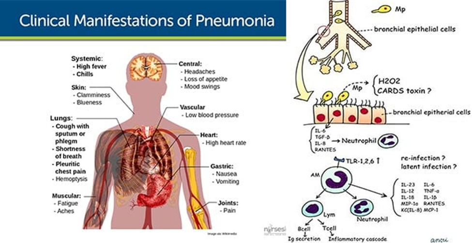 image 25 1 image 25 1