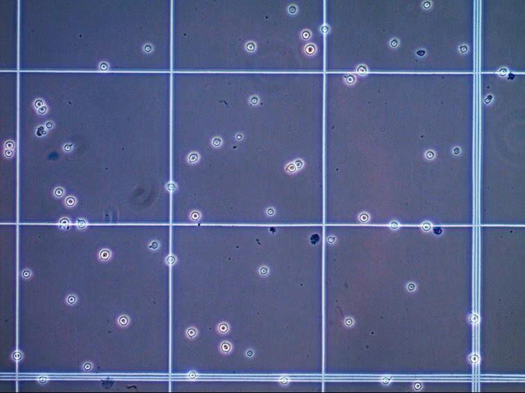 image 26 Trypan blue assay