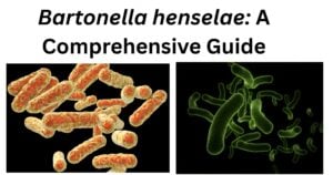 Bartonella henselae 1 Bartonella henselae