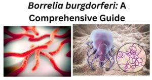 Borrelia burgdorferi Borrelia burgdorferi (Lyme Disease)