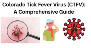 Colorado tick fever virus CTFV Colorado tick fever virus (CTFV)