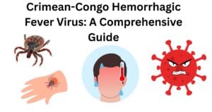 Colorado tick fever virus CTFV 1 Crimean-Congo Hemorrhagic Fever Virus (CCHFV)