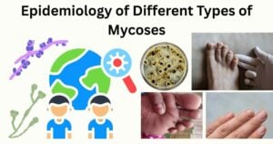 Epidemiology of Types of Mycoses Epidemiology of Types of Mycoses