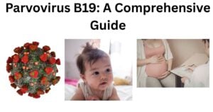 Parvovirus B19 Parvovirus B19