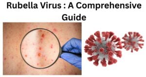 Rubella Virus Rubella Virus