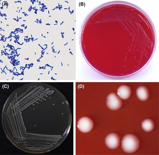 image 53 Microscopy and Cultural Characteristics of Bifidobacterium longum