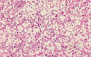 image 54 Gram staining of M. catarrhalis