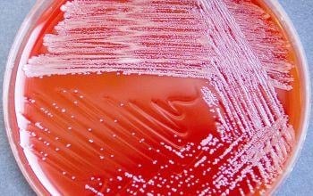 image 55 Growth of M. catarrhalis in Blood Agar