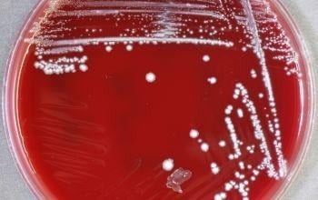image 56 Growth of F. nucleatum on blood agar