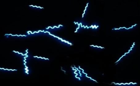 image 57 B. burgdorferi in dark field microscopy