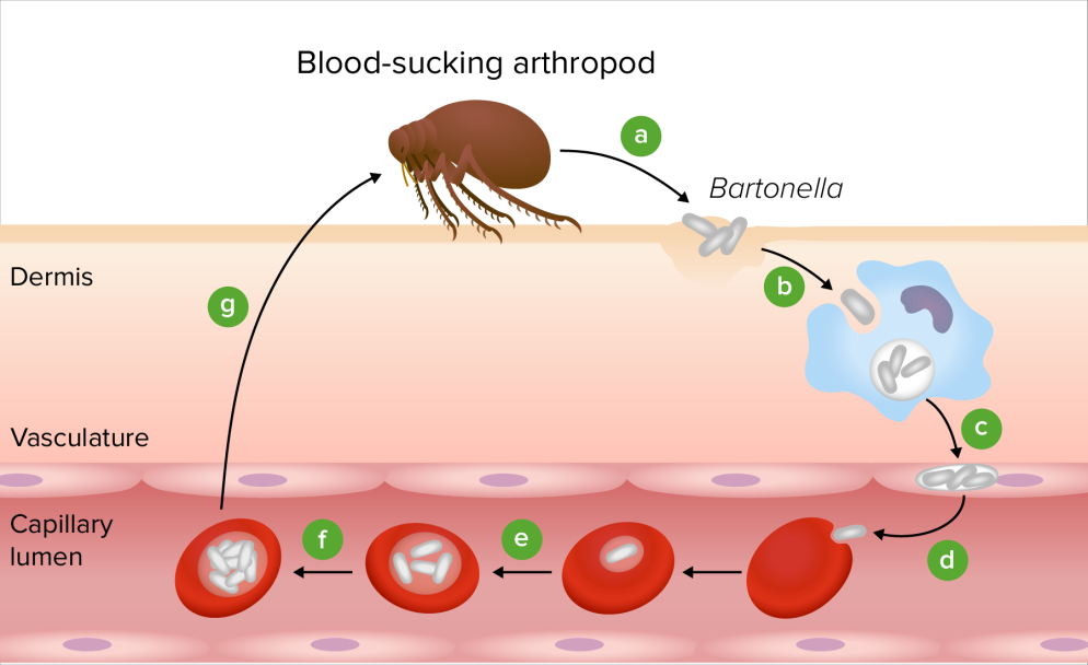 image 71 Pathogenesis of Bartonella henselae