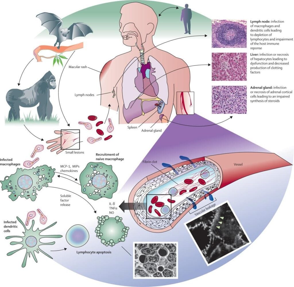 image 72 Model of Ebolavirus pathogenesis