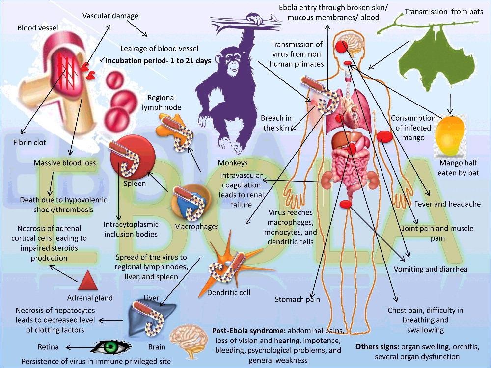 image 74 Transmission, pathogenesis, and clinical signs of Ebola virus