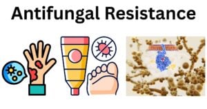 Antifungal Resistance Antifungal resistance