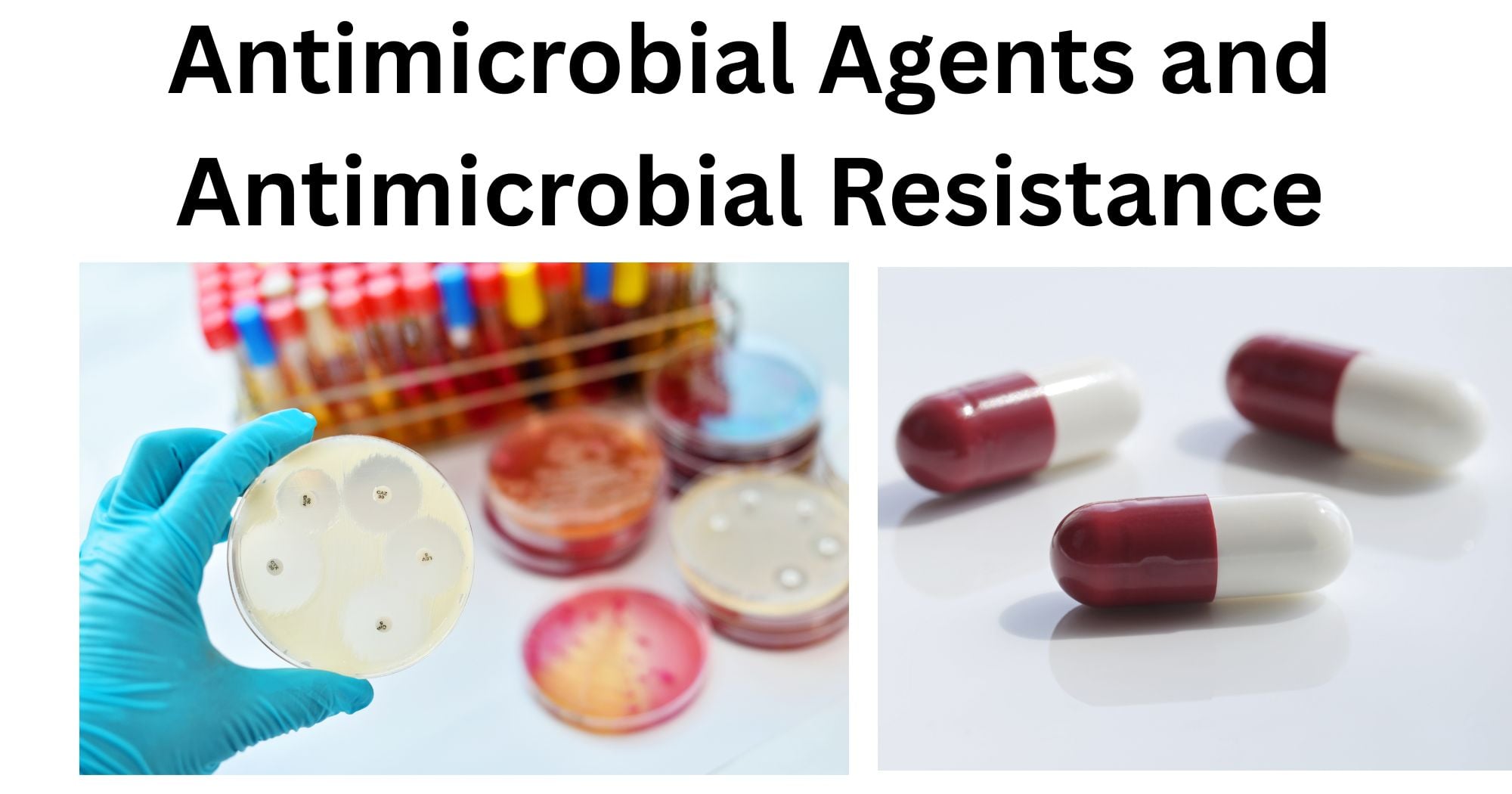 Antimicrobial Agents Antimicrobial Agents and Antimicrobial Resistance