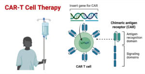 CAR T Cell Therapy CAR-T Cell Therapy