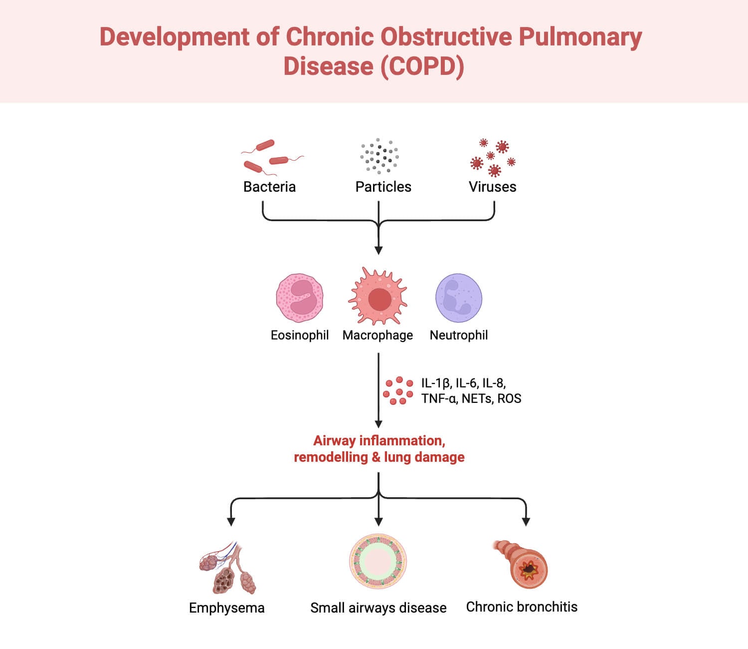 Development of Chronic Obstructive Pulmonary Disease COPD Development of Chronic Obstructive Pulmonary Disease (COPD)
