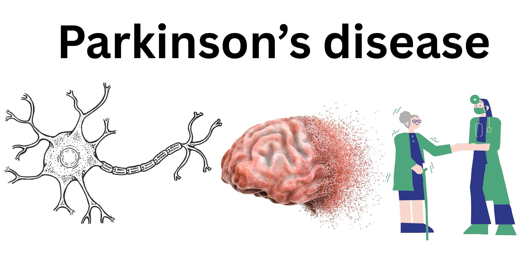 Parkinsons disease Parkinson’s disease (PD)