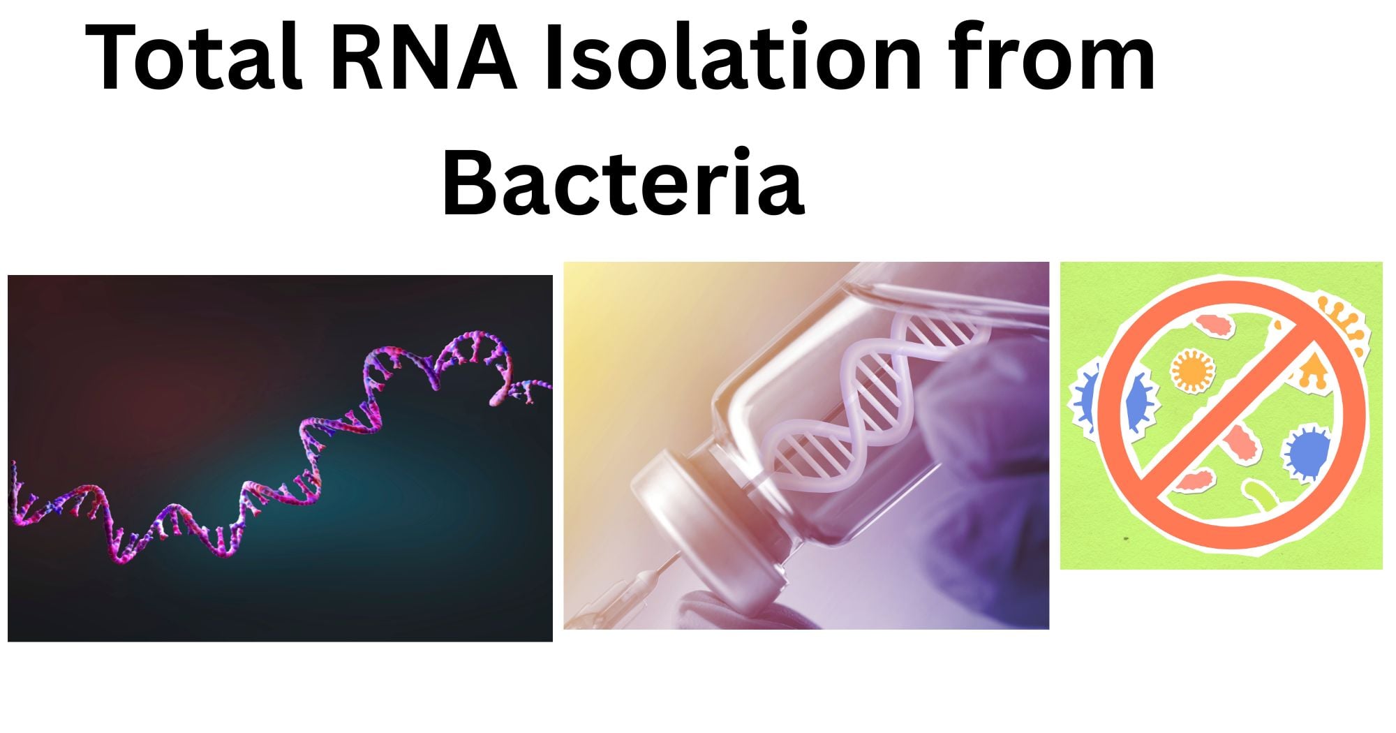 Total RNA Isolation from Bacteria Total RNA isolation from bacteria