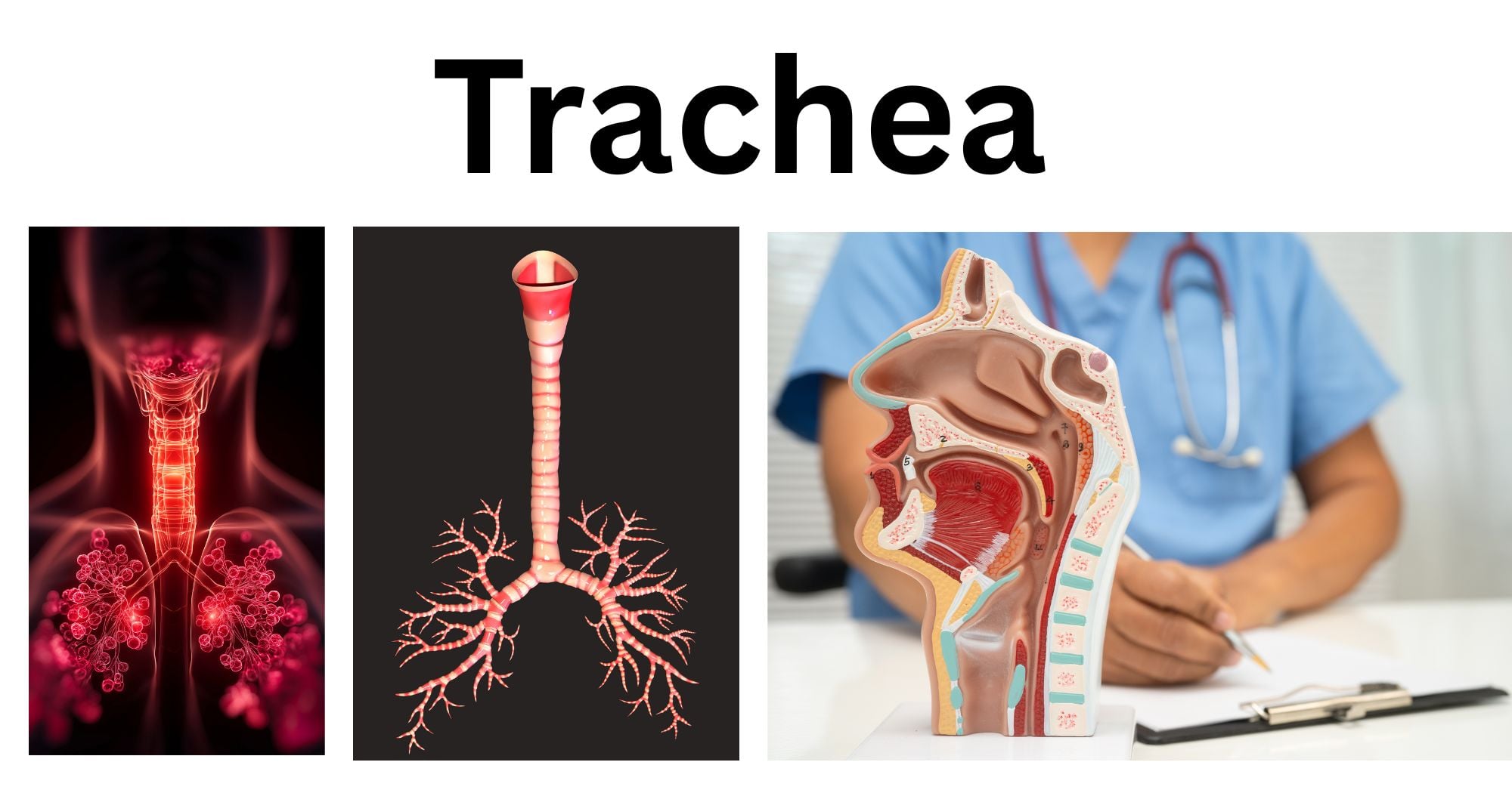 Trachea