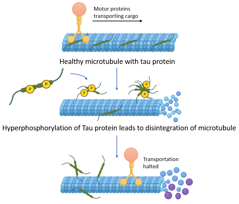image 177 Hyperphosphorylation of the Tau protein disintegrates microtubules