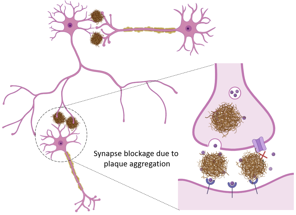 image 178 Synapse activity is disrupted by Aβ plaque aggregate