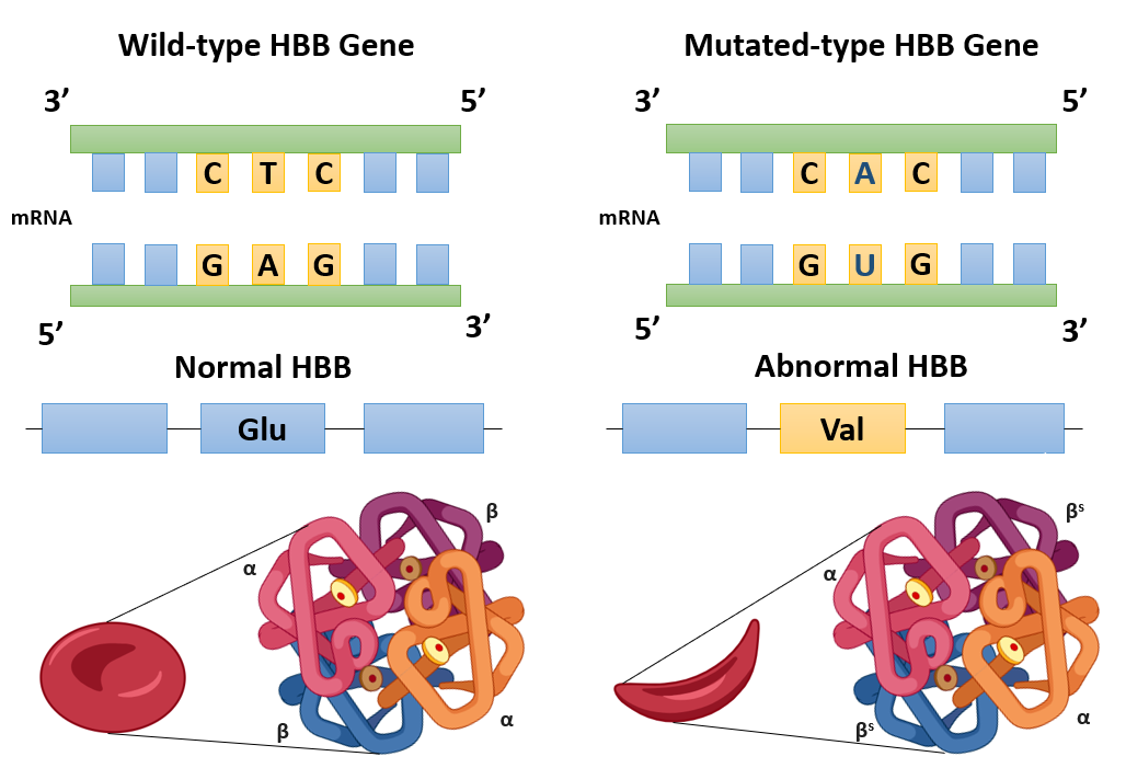 image 181 Â Mechanism of Sickle Cell Anemia
