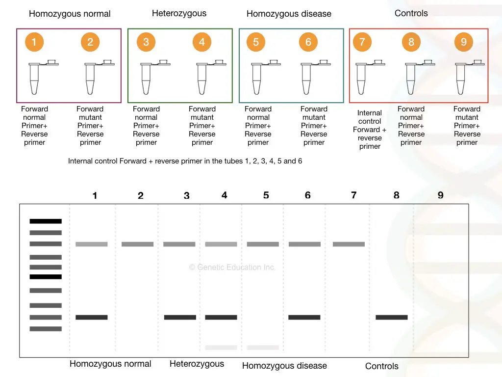 image 6 The whole process of ARMS-PCR, reaction preparation, and results analysis