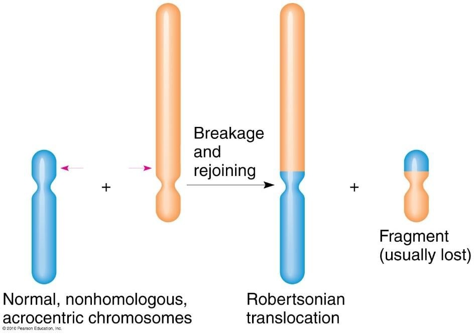 image 71 Robertsonian translocation