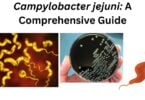 Campylobacter jejuni Campylobacter jejuni