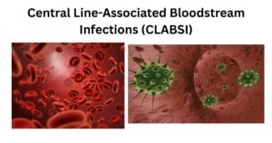 Central Line Associated Bloodstream Infections CLABSI Central Line-Associated Bloodstream Infections (CLABSI)
