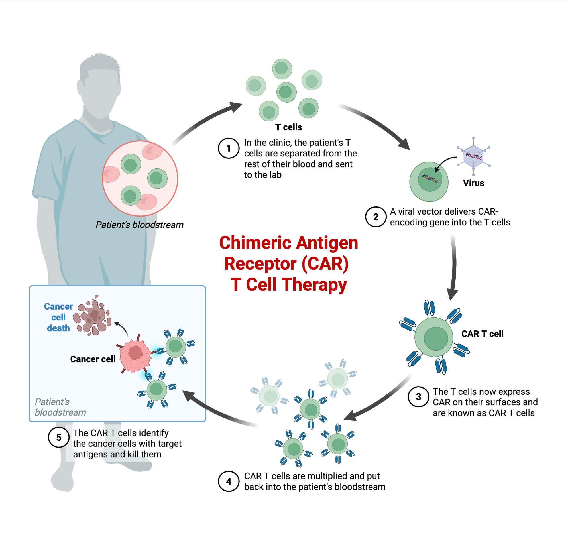 Chimeric Antigen Receptor CAR T Cell Therapy Vein to Vein Process Chimeric Antigen Receptor (CAR) T Cell Therapy Vein-to-Vein Process