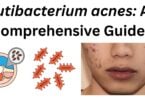Cutibacterium acnes Cutibacterium acnes