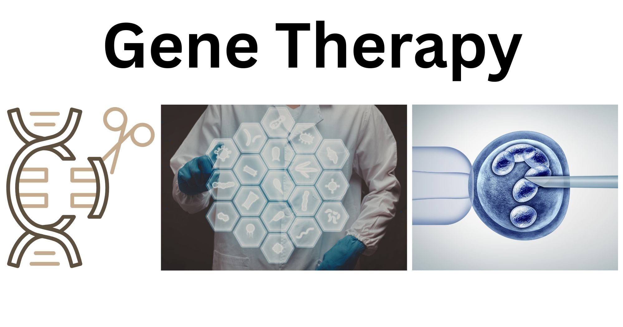 Gene Therapy Gene Therapy
