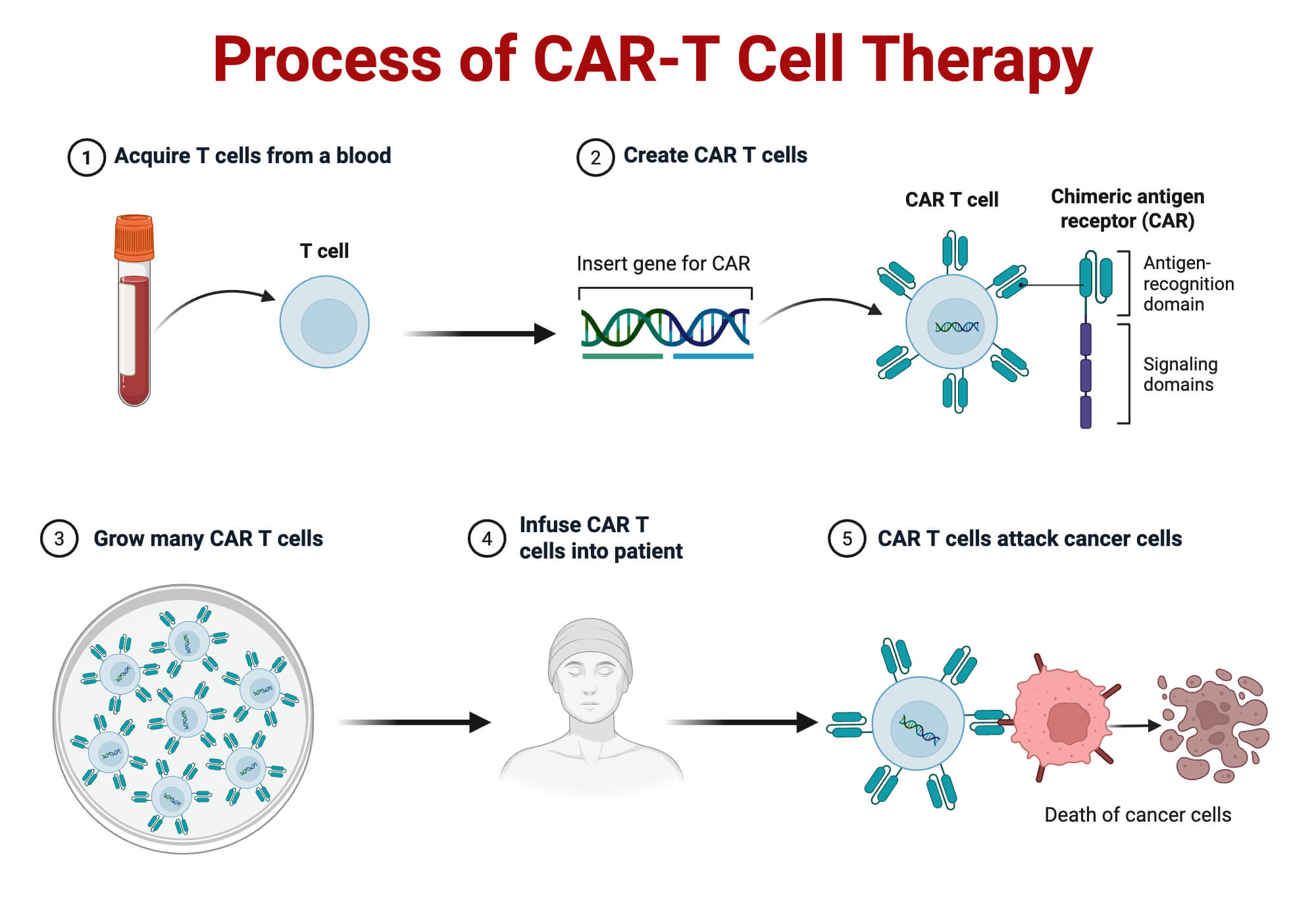 Process of CAR T Cell Therapy Process of CAR-T Cell Therapy