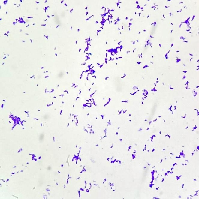 image 11 C. acnes gram stain showing non-spore forming gram positive rods in clumping arrangements from growth on agar plate