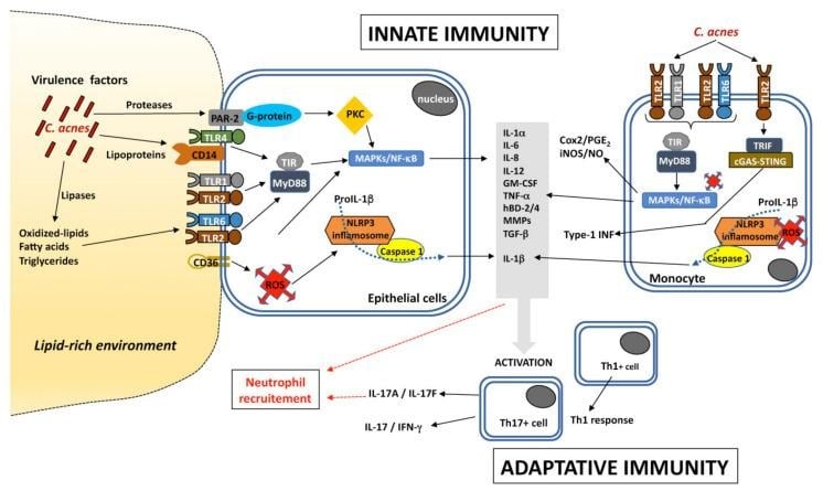 image 13 Inflammatory pathways induced by C. acnes