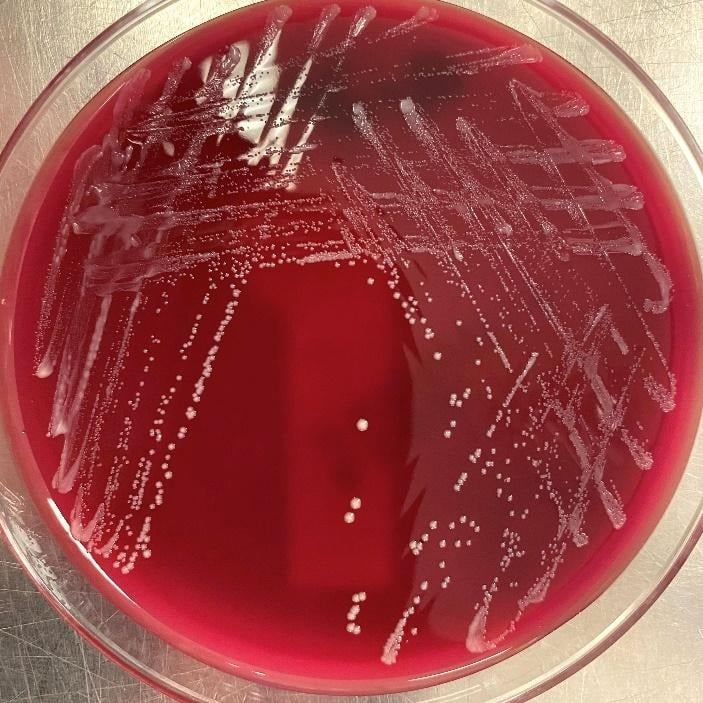 image 14 C. acnes growth on blood agar after anaerobic growth at 37° C