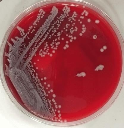 image 3 Colony of C. jejuni on Blood Agar