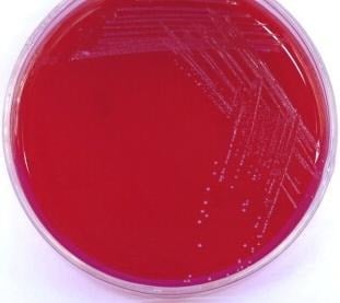image 5 Colony of B. bifidum on Blood AgarÂ