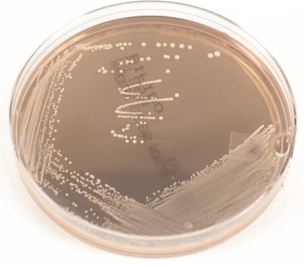 image 6 Colony of B. bifidum on Bifidobacterium Selective Medium