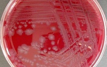 image 8 Colony of C. botulinum on Blood Agar