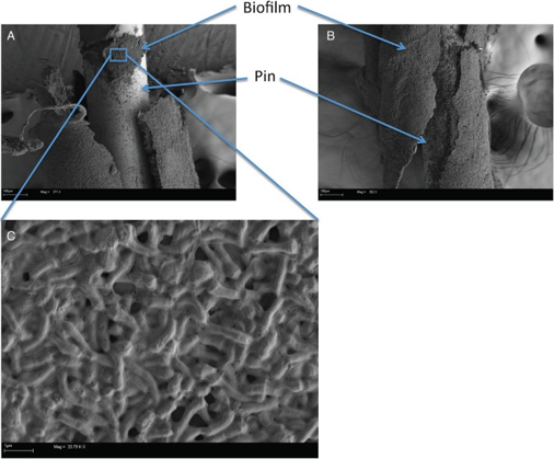 image 8 Scanning electron micrographs of C. acnes