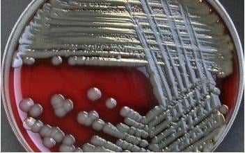 image Culture of A. hydrophila
