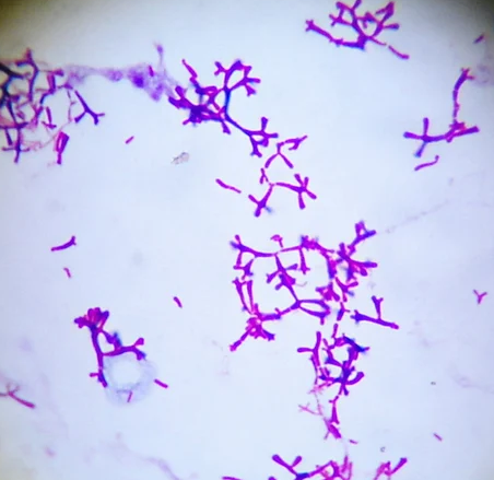 image Microscopy of B. bifidum