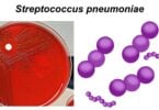 Streptococcus pneumoniae Streptococcus pneumoniae