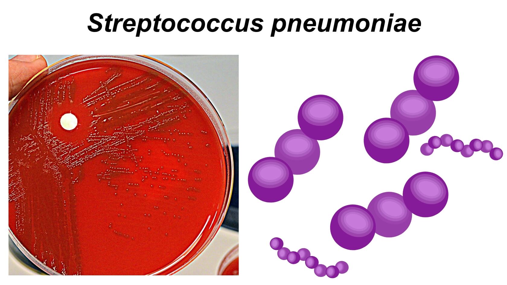 Streptococcus pneumoniae Streptococcus pneumoniae